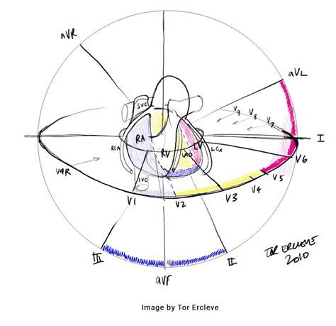 lead ekg    parts   practicing paramedicine