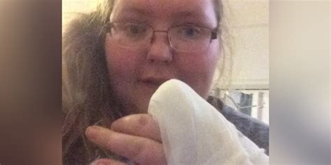 Irish Woman Cuts Off Her Own Finger Due To Chronic Pain The Mighty