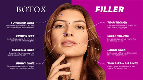 whats  difference  botox  dermal fillers