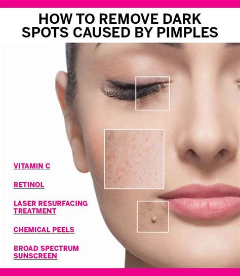 deformer se baisser present products  remove dark spots  face
