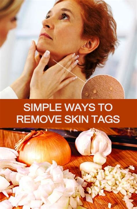simple ways to remove skin tags natural health and beauty skin tag removal skin tags home