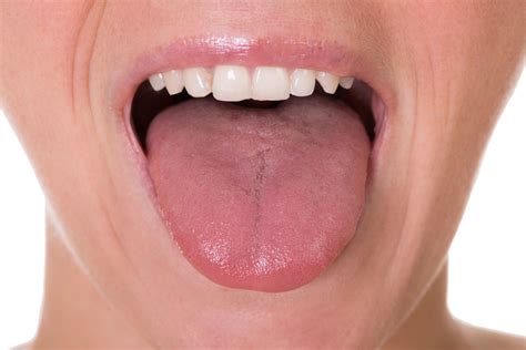 dentalfeature    swollen tongue cnw network