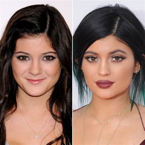 These Insane Celebrity Brow Transformations Are Proof That