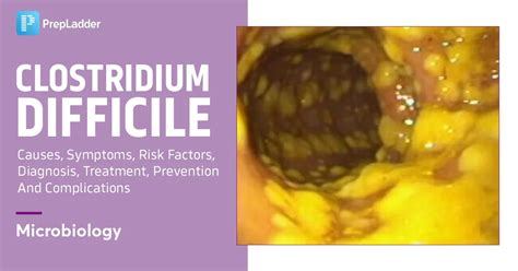 clostridium difficile  symptoms risk factors diagnosis