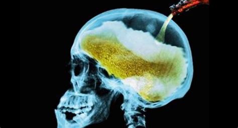 alcohol consumption    brain smartlivingenvironment