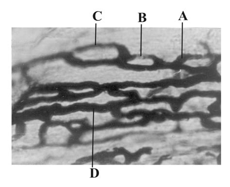 photomicrograph  capillary loops  internal  longitudinal layer  scientific