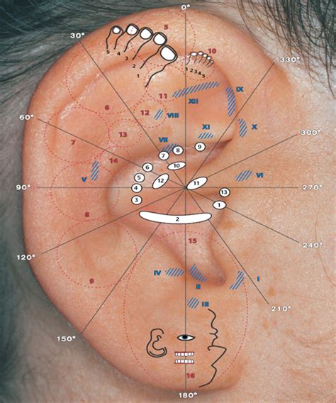 basic principles of auricular acupuncture musculoskeletal key