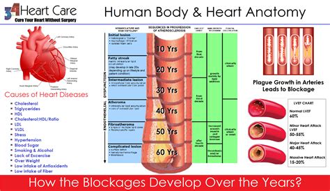 blockage human age correlation  heart care