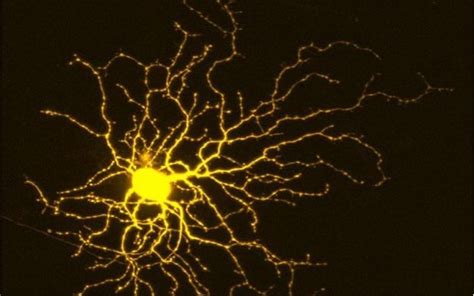 researchers discover clue    protect neurons  encourage