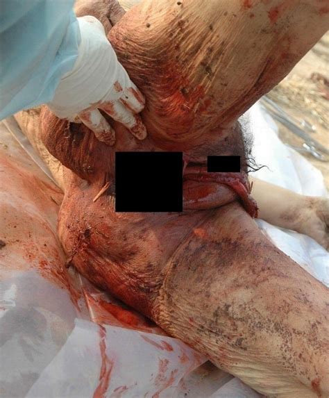 【超！閲覧注意】マ コから腸を出され、その腸で絞め殺された女性が発見される（画像） ポッカキット