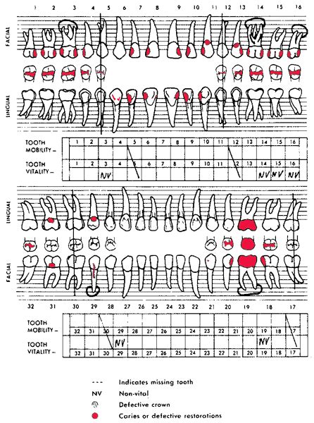 dental chart dental charting dental hygiene school dental assistant