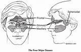 Nasal Paranasal Sinus Cavity Cancer Sinuses Surgery Mskcc Maxillary Node Ethmoid sketch template