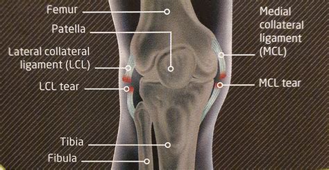 knee ligament injury klinique pain management wellbeing clinic
