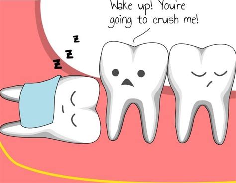 Wisdom Teeth The Treatment Centre Private And Nhs Dentist Truro