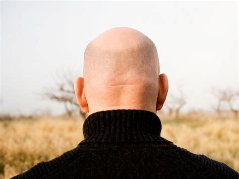 the bald truth how author nick coleman s thinning hair made him heir