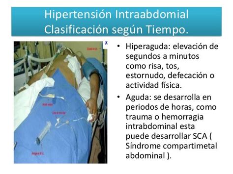 Hipertension Abdominal Y Sindrome Compartimental