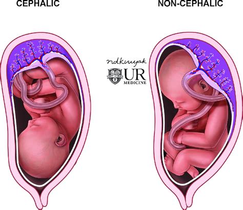 fetal positions illustration  cephalic   cephalic fetal