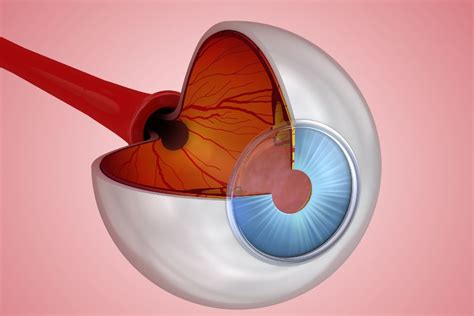 overview   choroid    affects vision rcmg blog