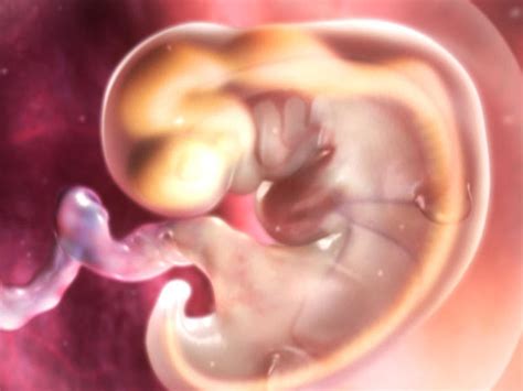 Sex of fetus when