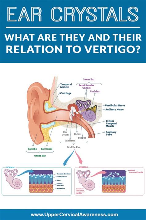 ear crystals      relation  vertigo