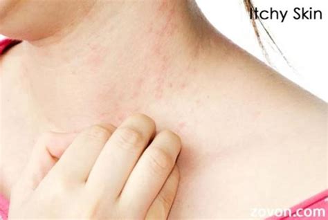 itchy skin symptoms   treatment