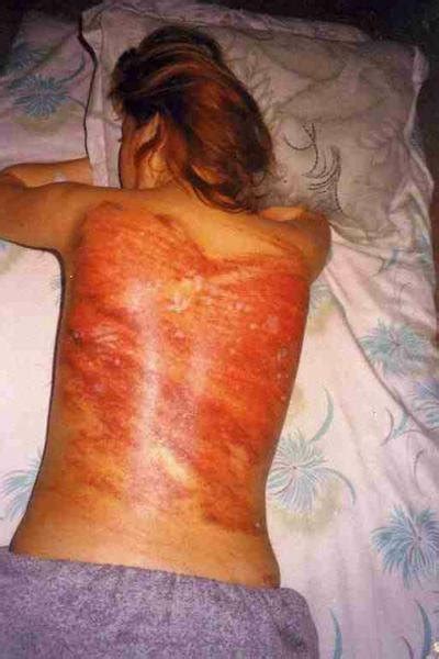 iran women torture image 4 fap