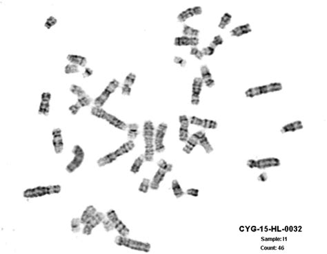 Microscope Xy Chromosome Micropedia
