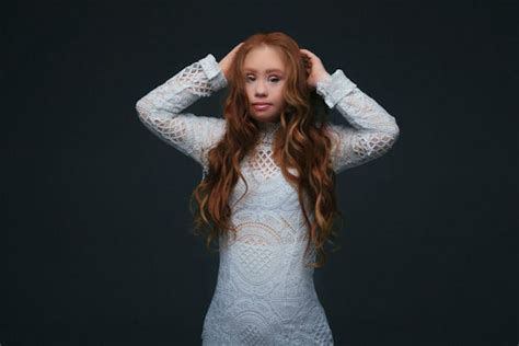 madeline stuart 18 year old model with down syndrome to