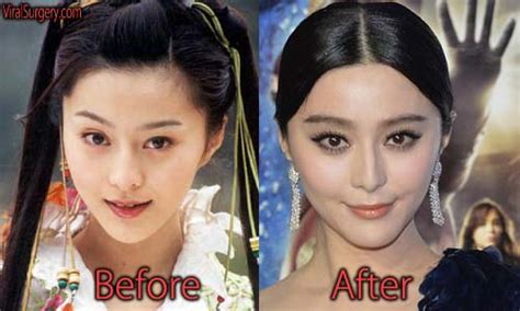 Fan Bingbing Plastic Surgery Before And After Boob Job