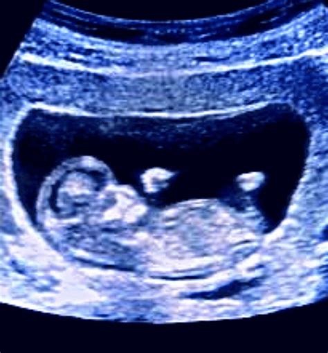 week ultrasound scan mybumpbaby