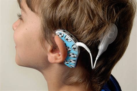 children  cochlear implants  risk  deficits  executive function medimoon