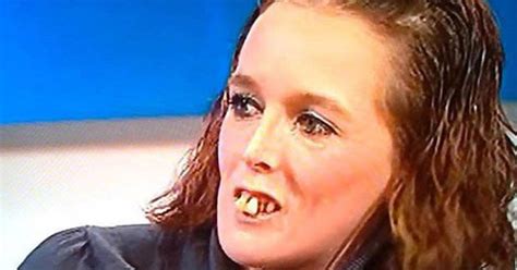 Jeremy Kyle ‘tooth Woman’ Is Unrecognisable After £10k Dental Makeover