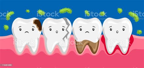 illustration of sick teeth in oral cavity stock illustration download