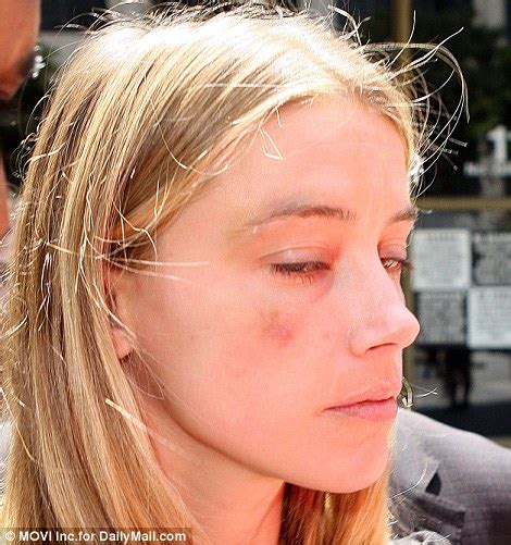 photos amber heard accuses johnny depp of attacking her files for restraining order this is
