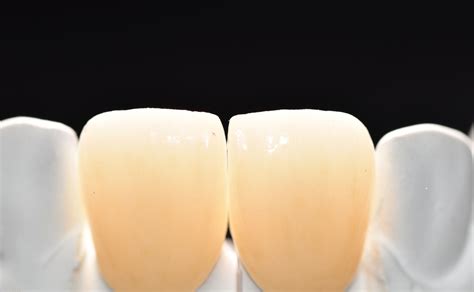 zirconia tooth crowns semdent
