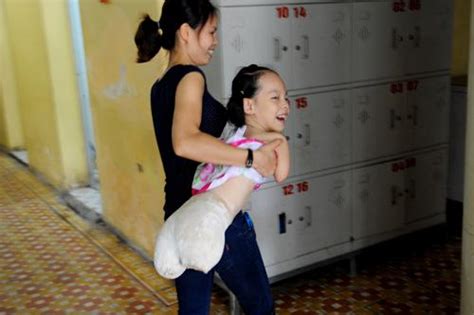 New Life With Artificial Limbs For The Limbless Girl News Vietnamnet