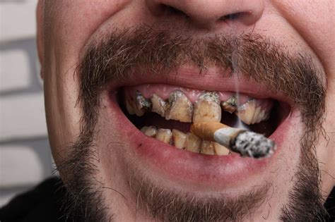 what tobacco does to your oral health west palm beach dentist