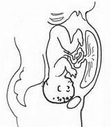 Placenta Anterior Baby Drawing Womb Pregnancy Position Behind Spinning Babies Fetal Front Choose Board Getdrawings Placental Hands Uterus Drawings Spinningbabies sketch template