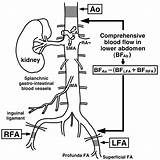 Ultrasound Aorta Abdominal Determination Inflows Comprehensive Arterial Getdrawings sketch template