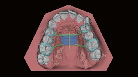 kfo apparaturen im digitalen workflow dentaldialogue