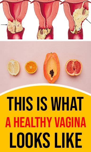 This Is What A Healthy Vagina Looks Like Healhty And Tips