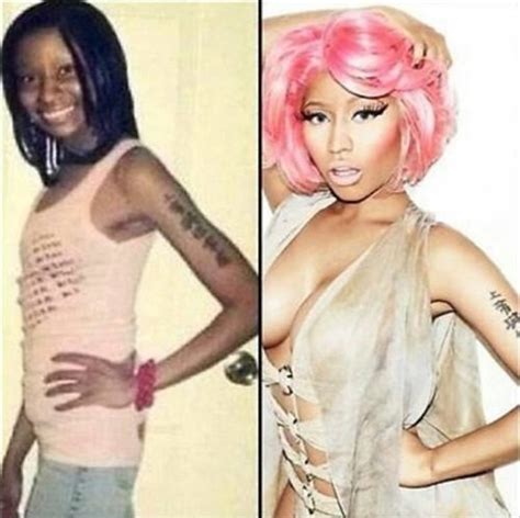 Shocking Nicki Minaj Before Plastic Surgery Pic