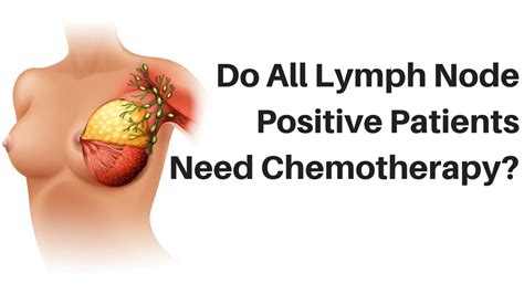 Do All Lymph Node Positive Breast Cancer Patients Need Chemotherapy