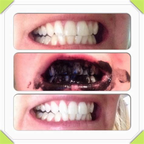 natural teeth whitening😁 👌 musely