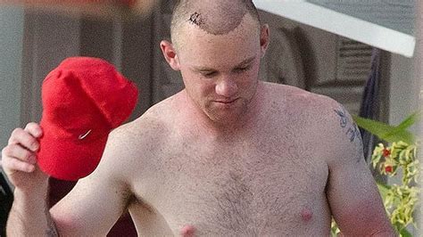 wayne rooney hair transplant results shown off on the beach in barbados