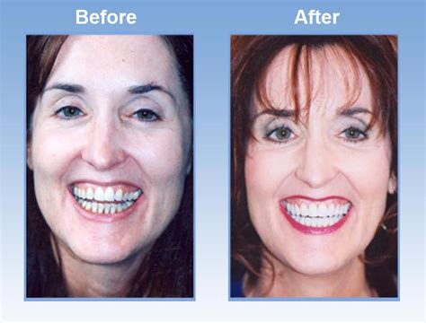 cosmetic dental surgery    dental news network