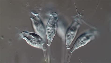 Epistylis Ciliate Light Microscope Footage Of A Group Of