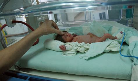 Doctors Cut Rates Of Preterm Birth With Five Steps The World From Prx
