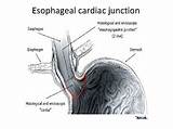 Junction Esophageal Esophagus Gastro Histology Cardiac sketch template