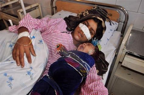 afghan woman s nose is cut off by her husband officials say the new